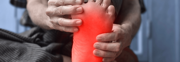 Diagnosis and Treatment of Plantar Fasciitis