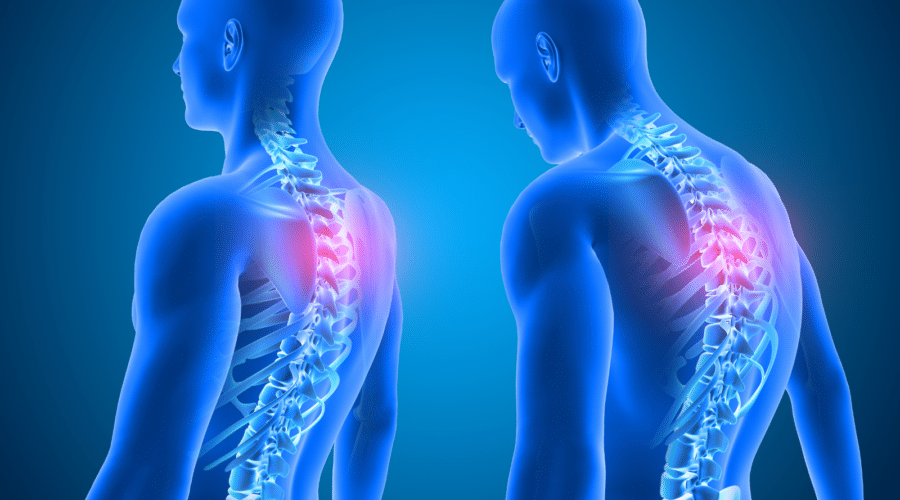 How To Improve Your Posture