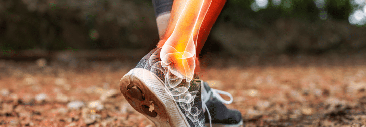 How to Prevent and Treat Running Injuries